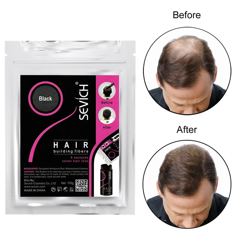 Sevich 100g Hair Fibers Refill Bag Bald Extension Hair Growth Powder Salon Professional Hair Treatment Unisex Hair Loss Products