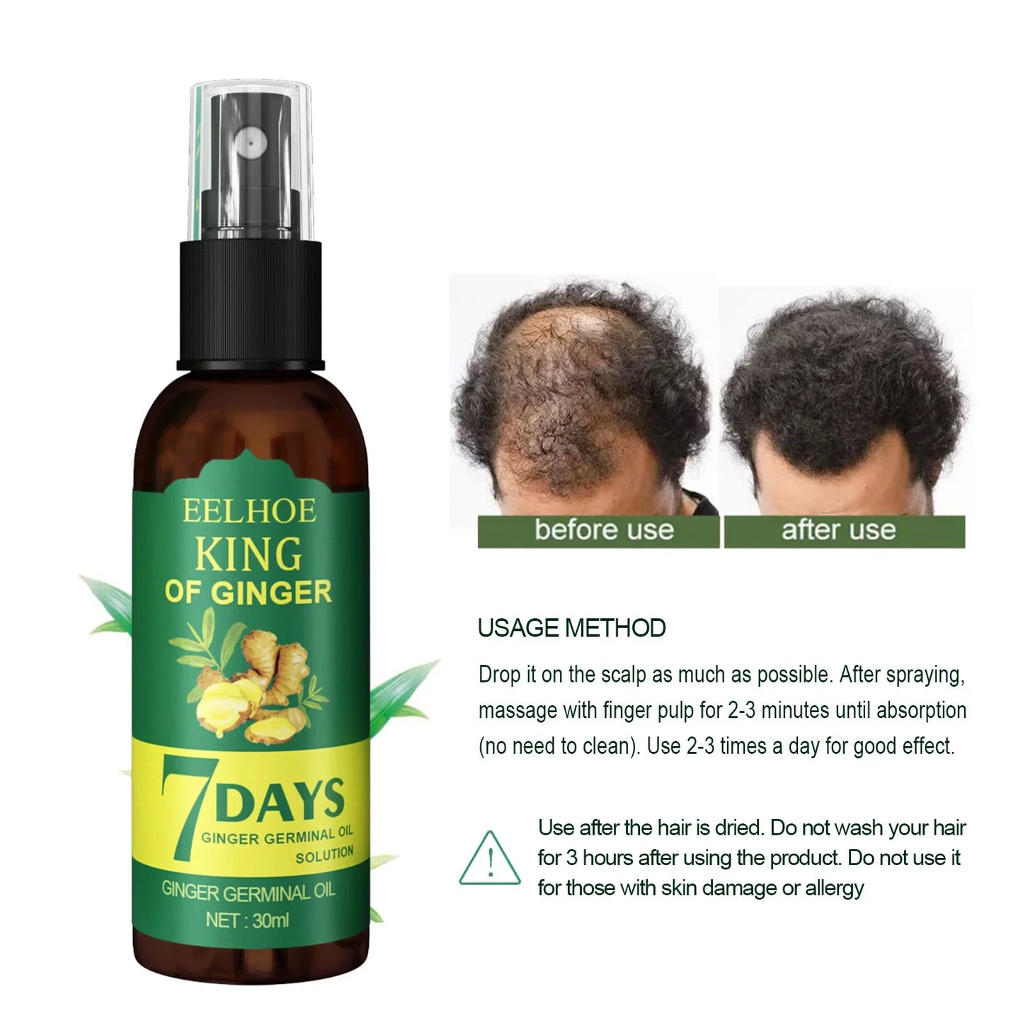 EELHOE Hair Growth Spray 7 Day Ginger Serum Scalp Damaged Treatement Prevent Hair Loss Effective Fast Growth Massage Liquid 50ml