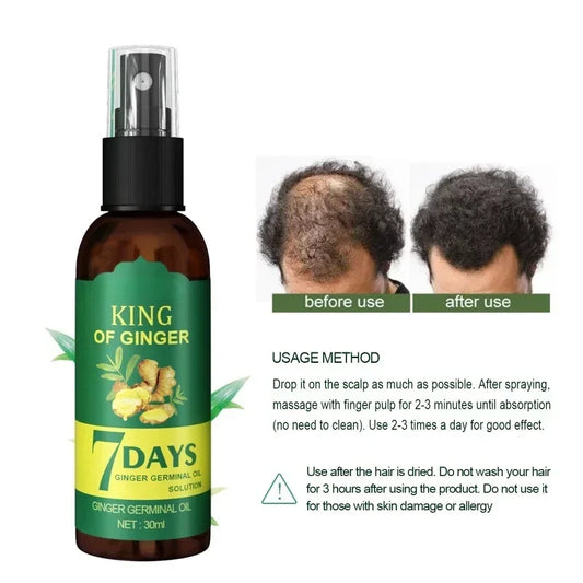 Ginger Hair Growth Spray Strengthening-Hair Massage Scalp Dense-Hair Strengthening Hair Loss Prevention Repair Nourishing Liquid