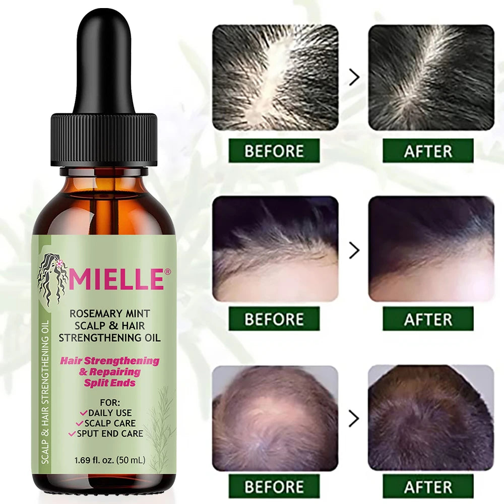 Hair Growth Essential Oil Rosemary Mint Hair Strengthening Oil Nourishing Treatment for Dry Mielle Organics and Split Ends Hair