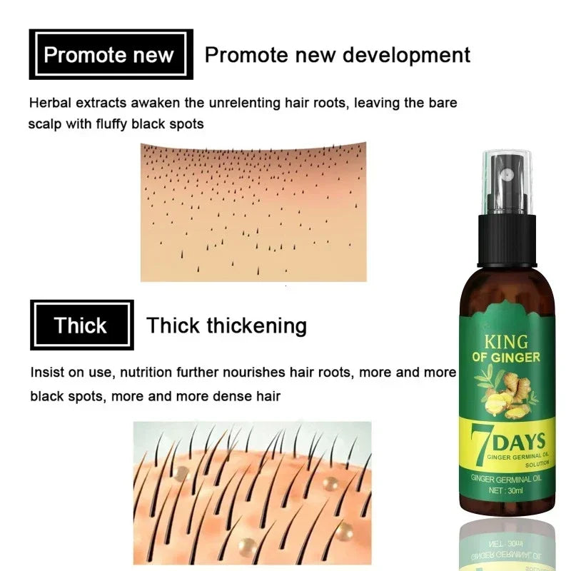 Ginger Hair Growth Spray Strengthening-Hair Massage Scalp Dense-Hair Strengthening Hair Loss Prevention Repair Nourishing Liquid