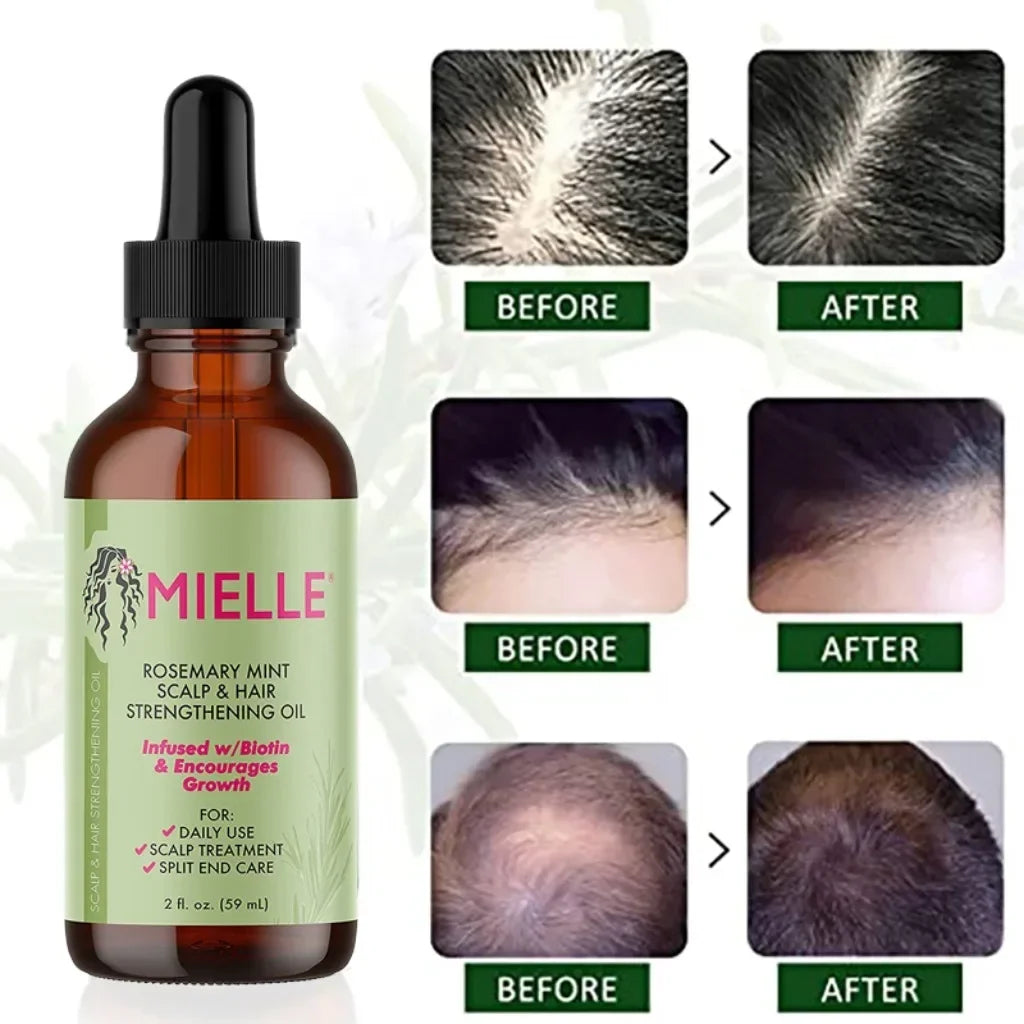 Hair Growth Essential Oil Rosemary Mint Hair Strengthening Oil Nourishing Treatment for Split Ends and Dry Organics Hair