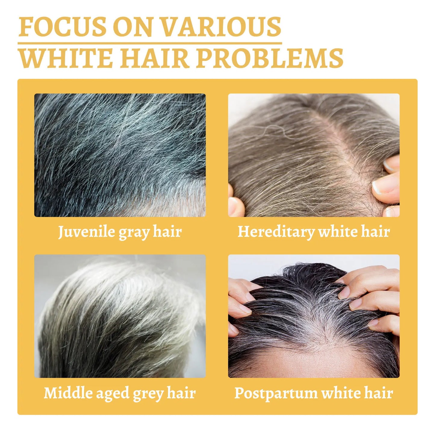 Gray White Hair Treatment Serum Liquid White To Black Natural Color Repair Nourish Product Anti Loss Hair Care Essence Men Women