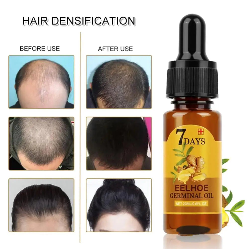 Hair Growth Essential Oils Repair Damaged Hair Anti Hair Loss Prevent Hair Loss Oil Ginger Fast Growing Hair Essential Oil